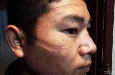 湖北省首次！輔警集體被記三等功